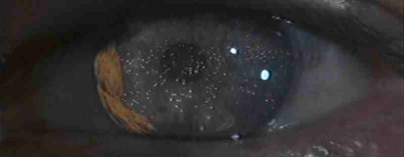 L'occhio del replicante visto attraverso la macchina Esper